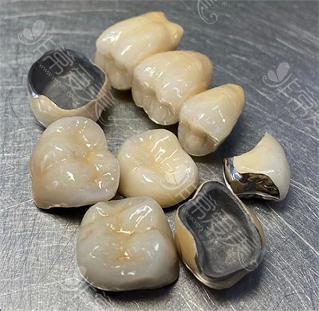 贵金属烤瓷牙的危害(贵金属烤瓷牙多少钱一颗)