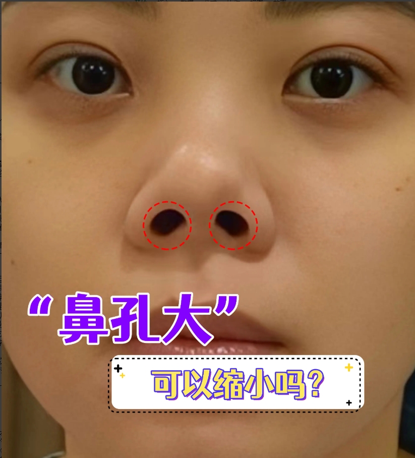 币钱通(逼前男友写百万借条)